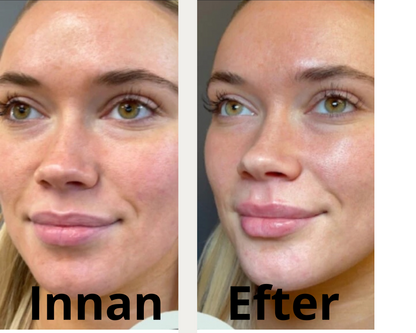 Dr. Melaxin Hydra Stick